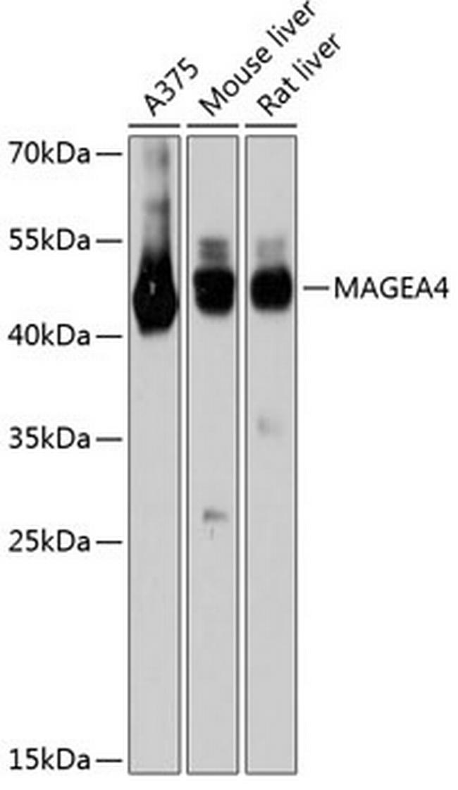 MAGEA4 Antibody in Western Blot (WB)