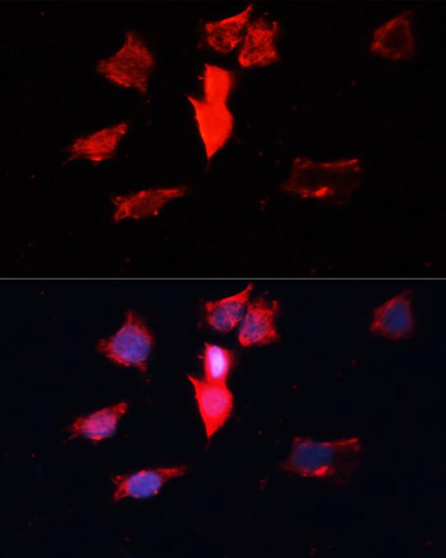 Calmodulin 3 Antibody in Immunocytochemistry (ICC/IF)