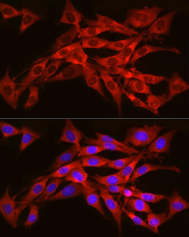 SEC61A1 Antibody in Immunocytochemistry (ICC/IF)