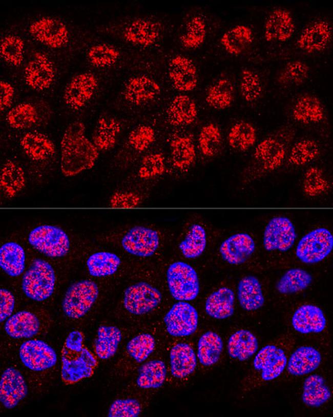 hnRNP A2B1 Antibody in Immunocytochemistry (ICC/IF)