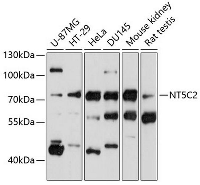 NT5C2 Antibody in Western Blot (WB)