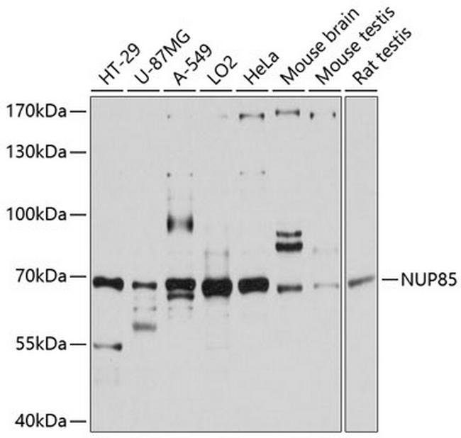 NUP85 Antibody in Western Blot (WB)