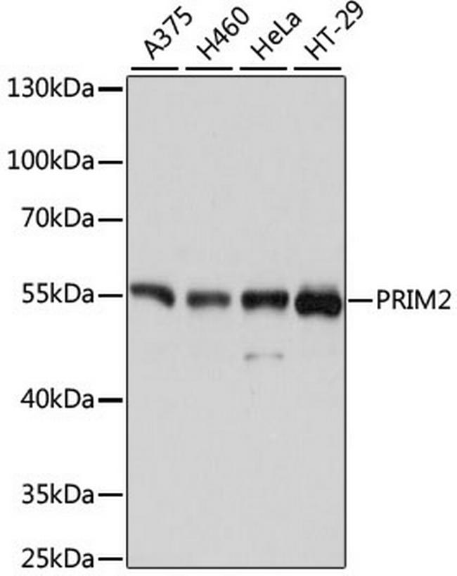 PRIM2 Antibody in Western Blot (WB)