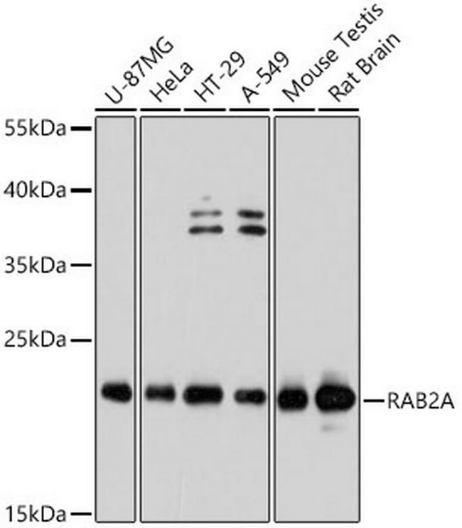 RAB2A Antibody in Western Blot (WB)