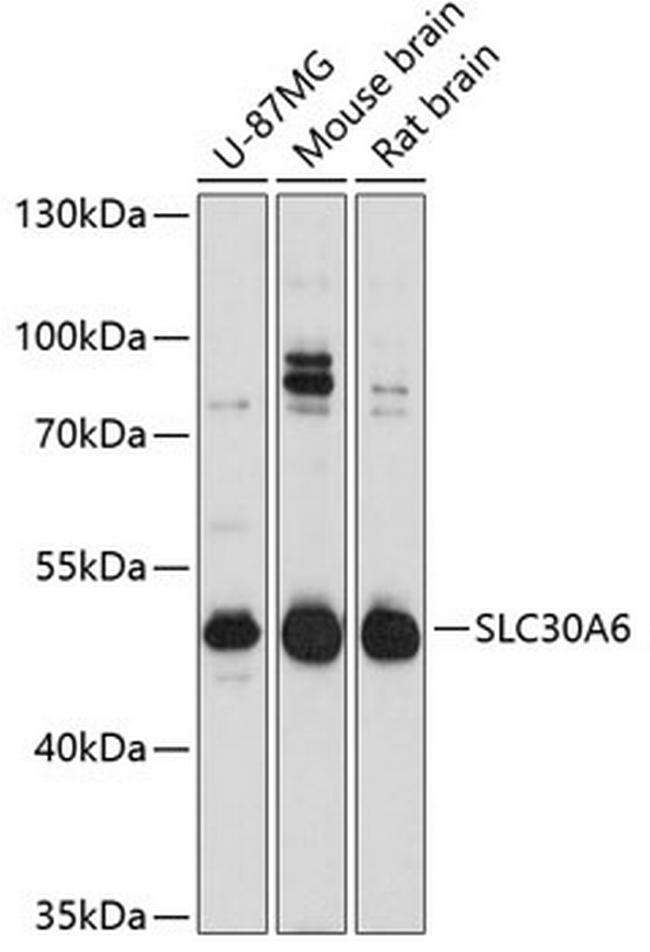 SLC30A6 Antibody in Western Blot (WB)