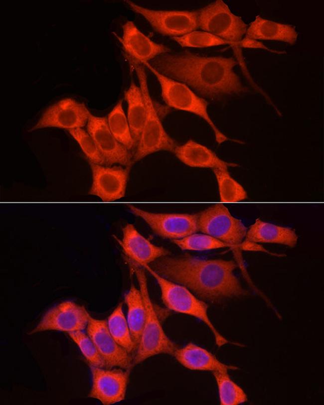 RPS18 Antibody in Immunocytochemistry (ICC/IF)