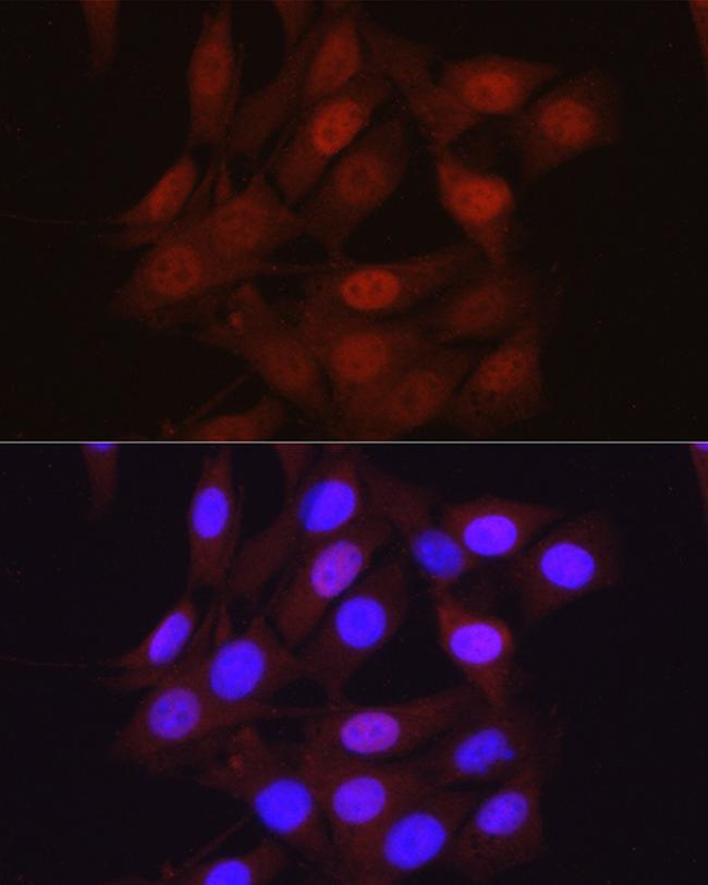 beta-Arrestin 2 Antibody in Immunocytochemistry (ICC/IF)