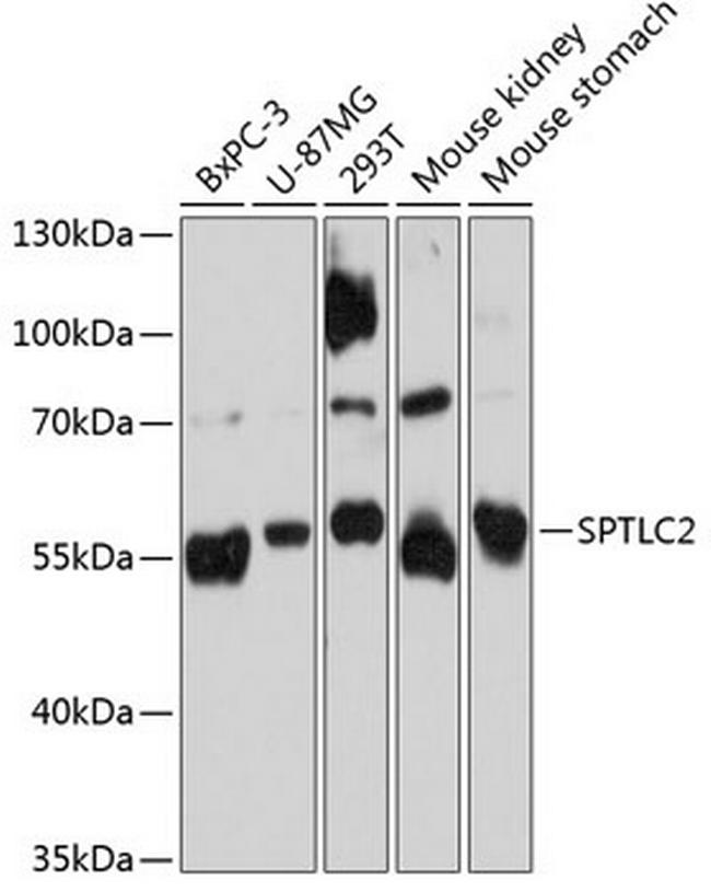 SPTLC2 Antibody in Western Blot (WB)