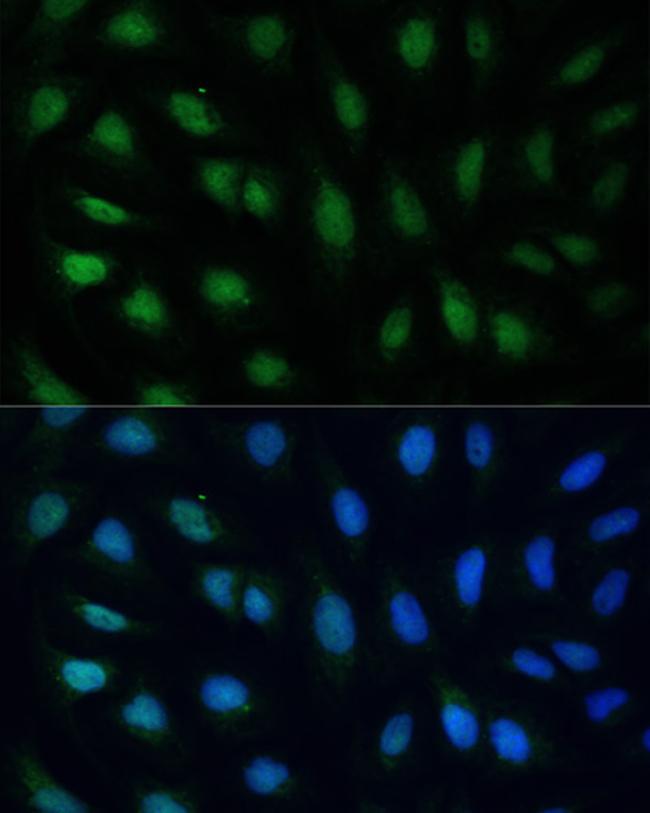 GADD45A Antibody in Immunocytochemistry (ICC/IF)