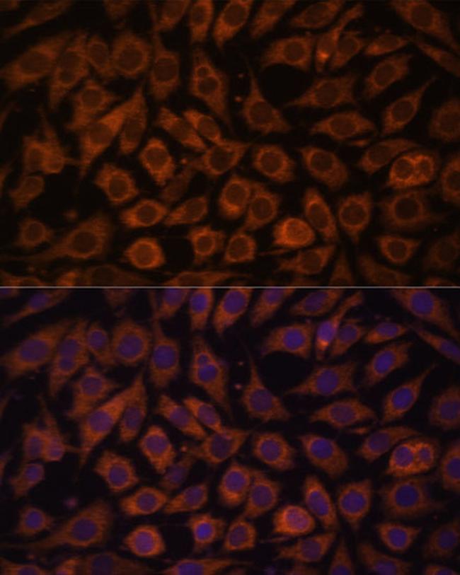 TLR3 Antibody in Immunocytochemistry (ICC/IF)