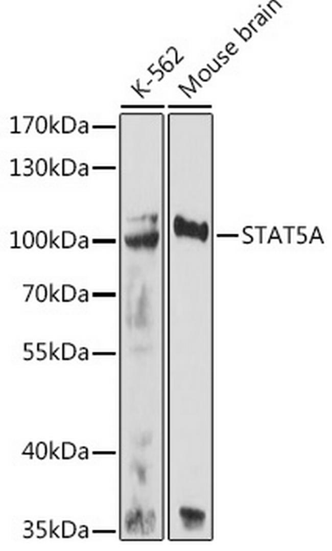 STAT5 alpha Antibody in Western Blot (WB)