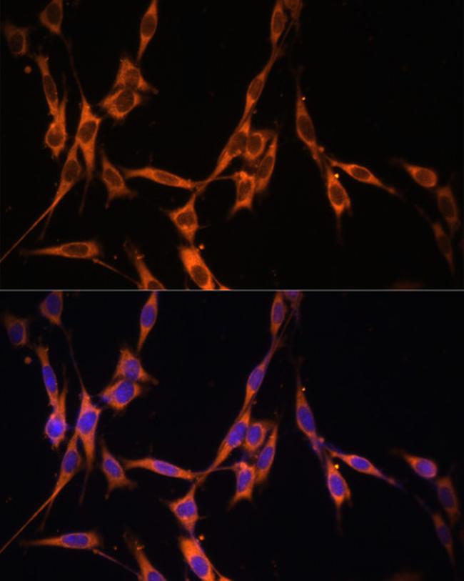 K-Ras Antibody in Immunocytochemistry (ICC/IF)