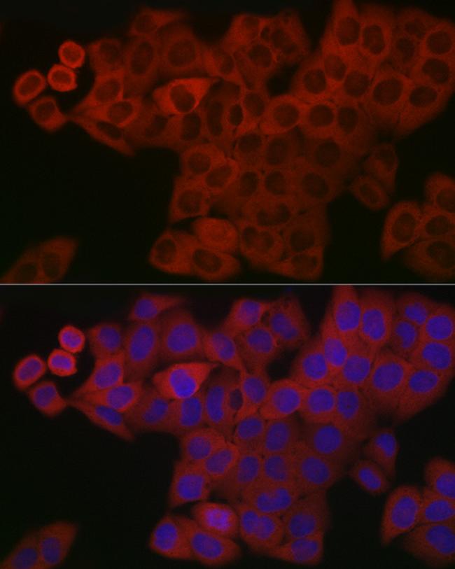 PDGF-BB Antibody in Immunocytochemistry (ICC/IF)