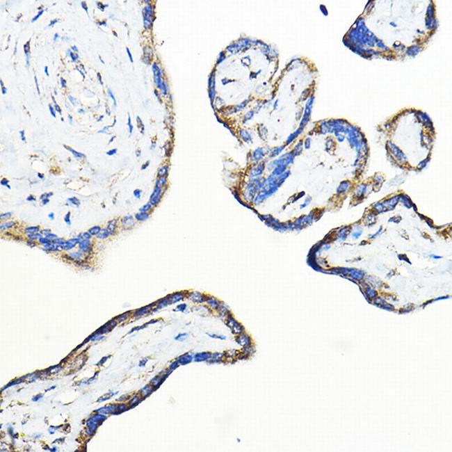 LNPEP Antibody in Immunohistochemistry (Paraffin) (IHC (P))