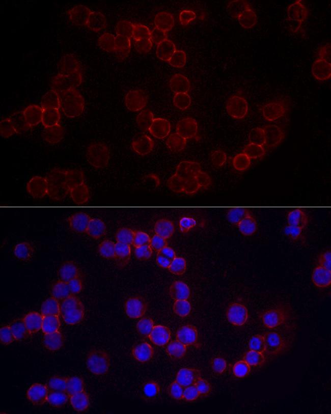 CD86 Antibody in Immunocytochemistry (ICC/IF)