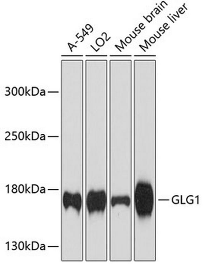 GLG1 Antibody in Western Blot (WB)