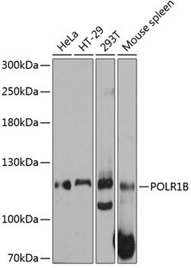 POLR1B Antibody in Western Blot (WB)