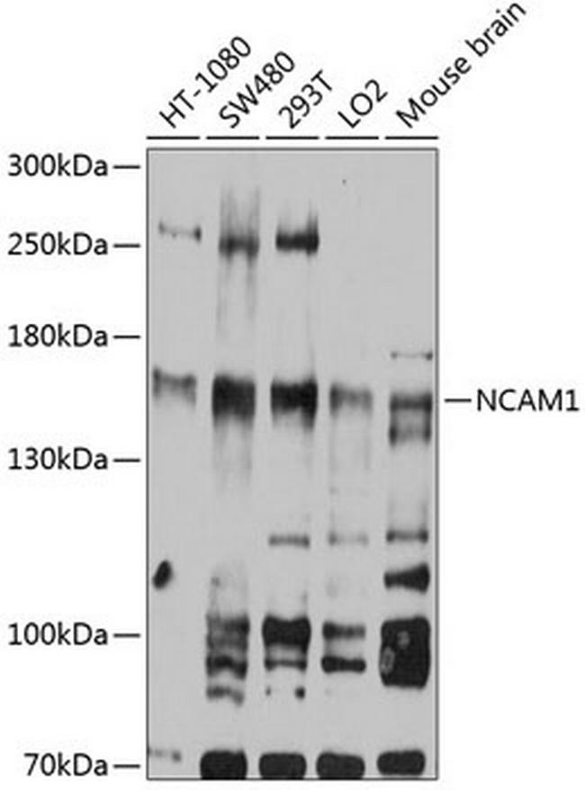 CD56 Antibody in Western Blot (WB)