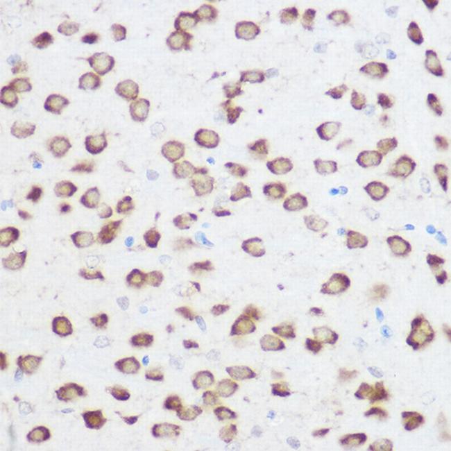 RPS24 Antibody in Immunohistochemistry (Paraffin) (IHC (P))