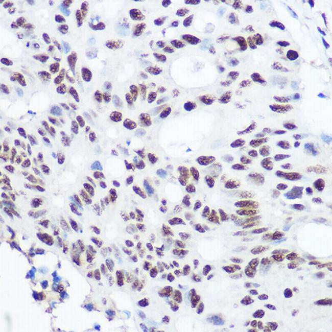 SART3 Antibody in Immunohistochemistry (Paraffin) (IHC (P))