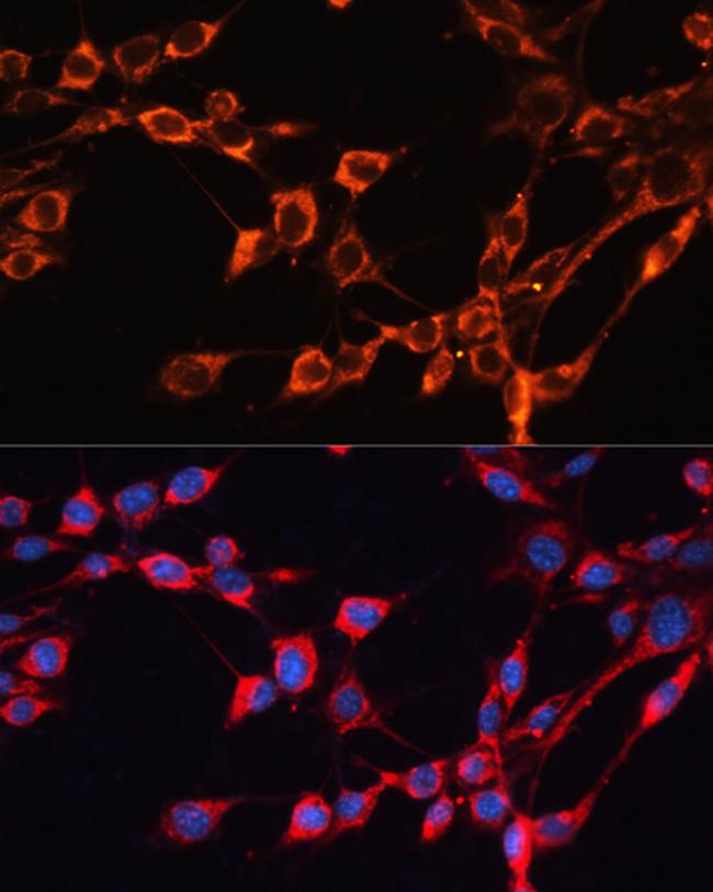 SLC25A24 Antibody in Immunocytochemistry (ICC/IF)