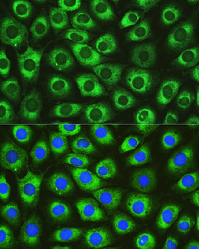 DNAJC10 Antibody in Immunocytochemistry (ICC/IF)