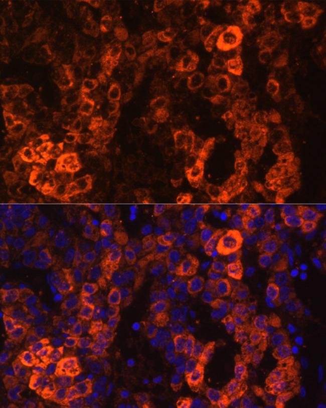 BHMT Antibody in Immunocytochemistry (ICC/IF)