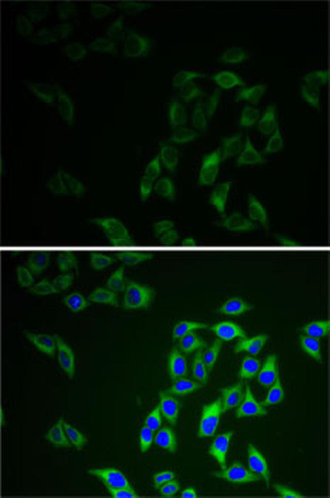 Adenylate Kinase 1 Antibody in Immunocytochemistry (ICC/IF)