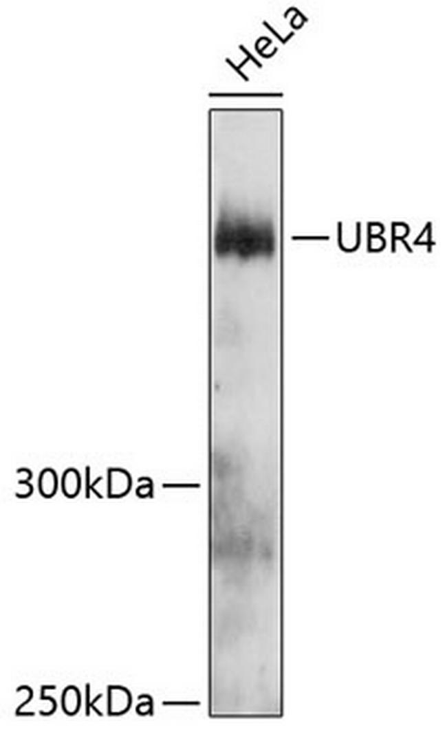 UBR4 Antibody in Western Blot (WB)