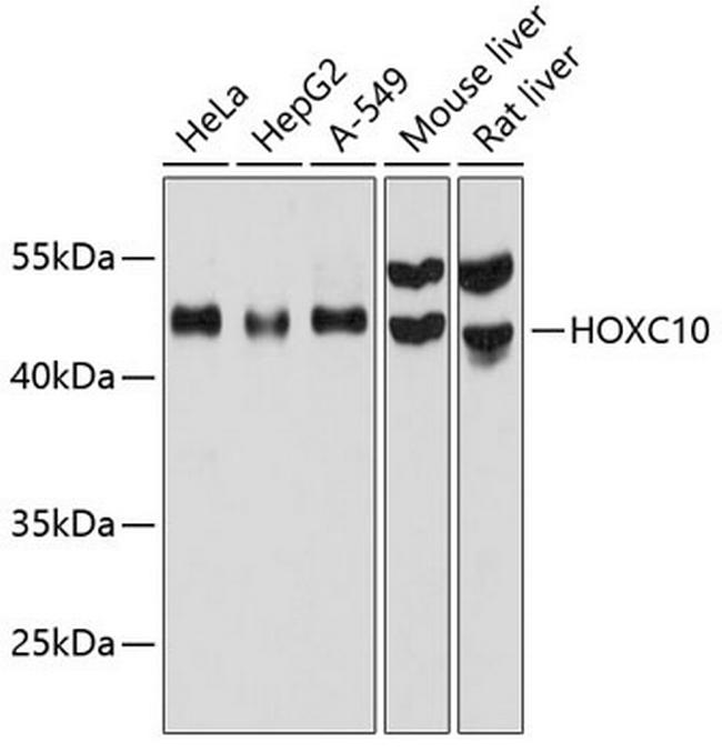 HOXC10 Antibody in Western Blot (WB)