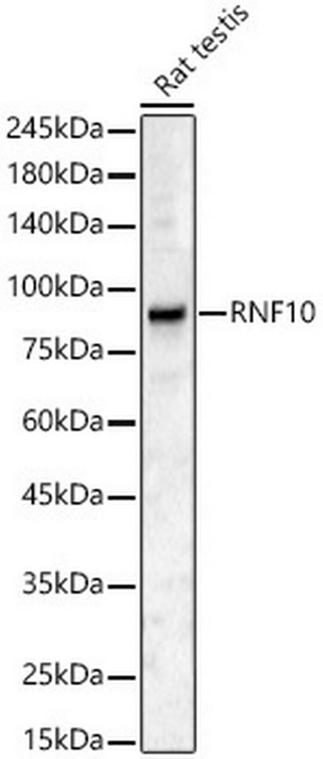 RNF10 Antibody in Western Blot (WB)