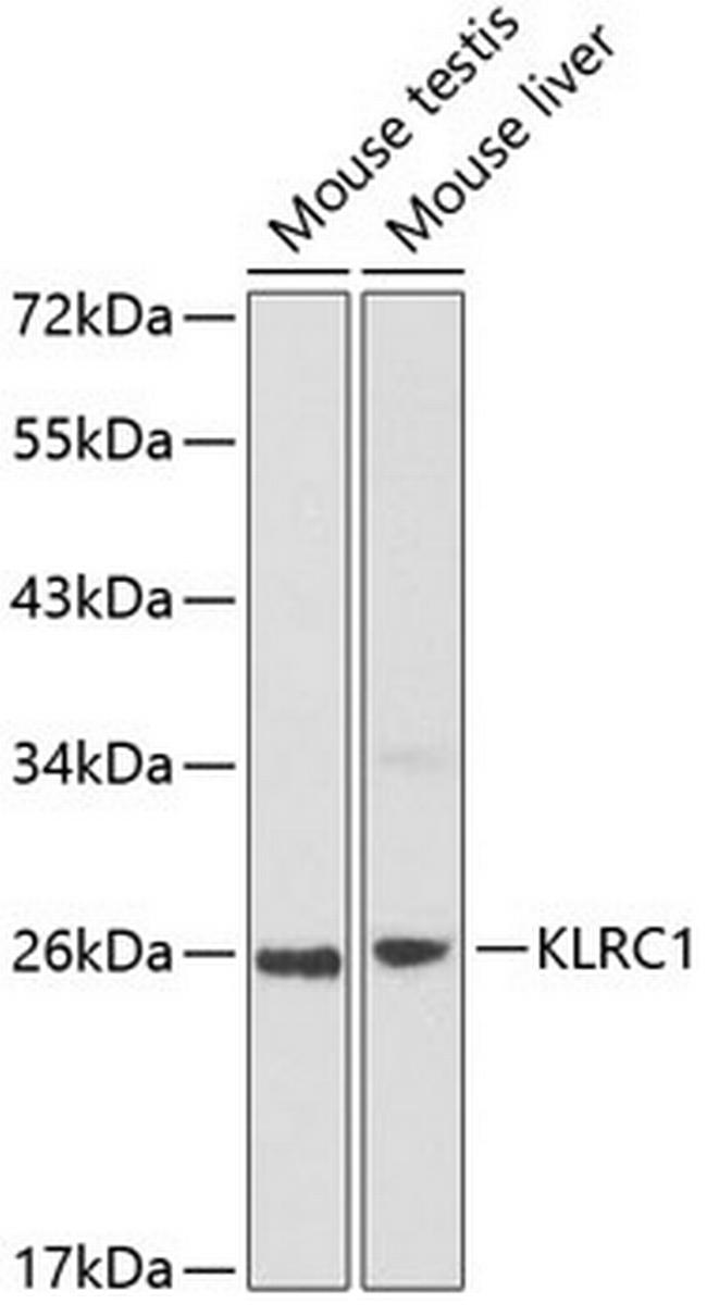 NKG2A Antibody in Western Blot (WB)