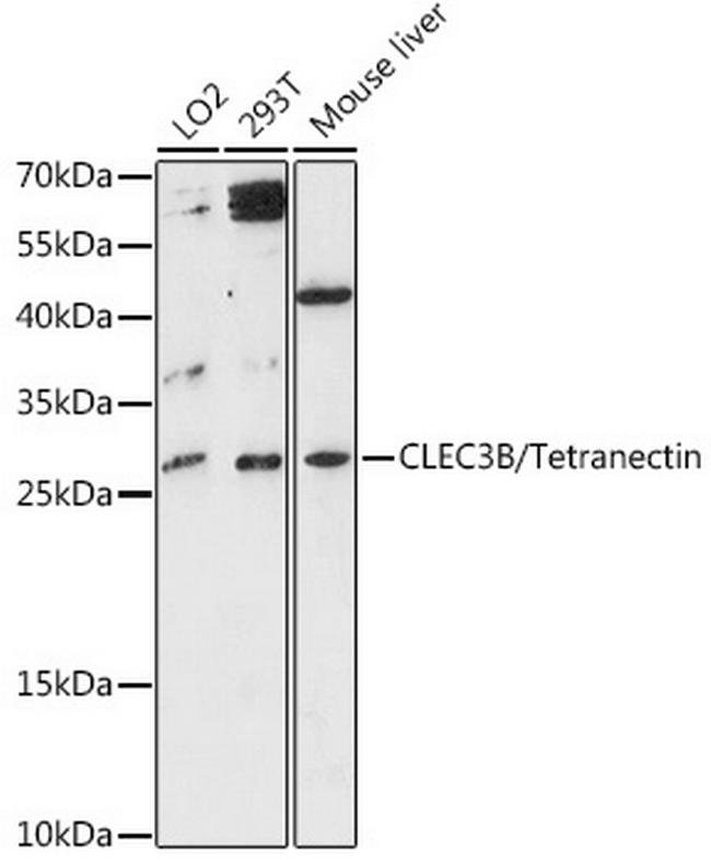 Tetranectin Antibody in Western Blot (WB)