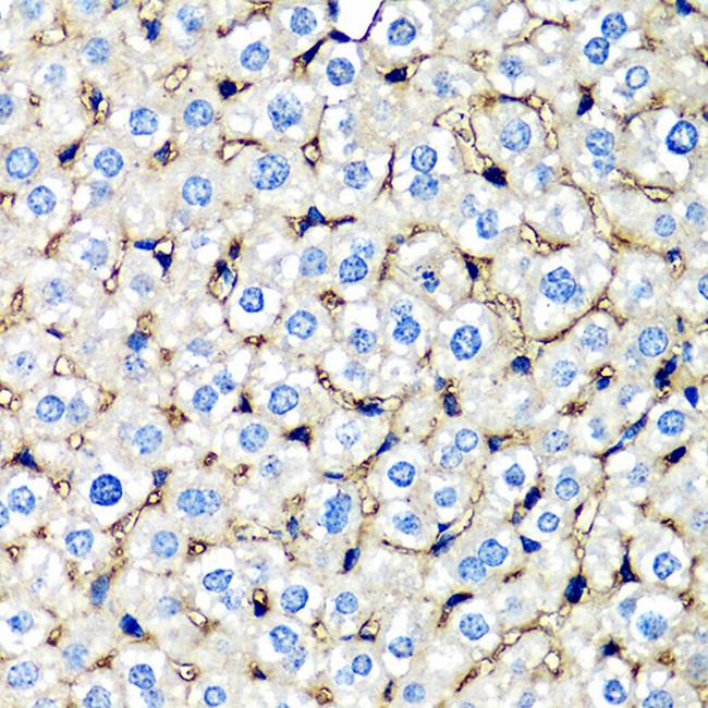 beta-2 Microglobulin Antibody in Immunohistochemistry (Paraffin) (IHC (P))