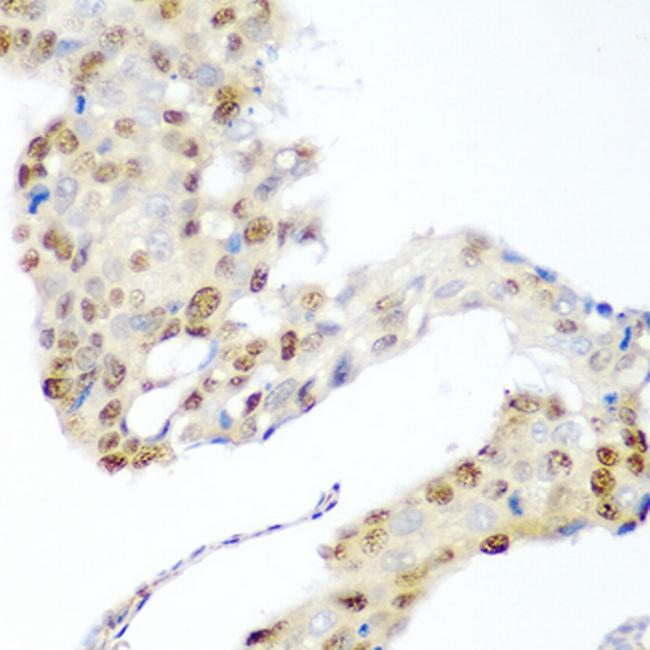 CDK1 Antibody in Immunohistochemistry (Paraffin) (IHC (P))