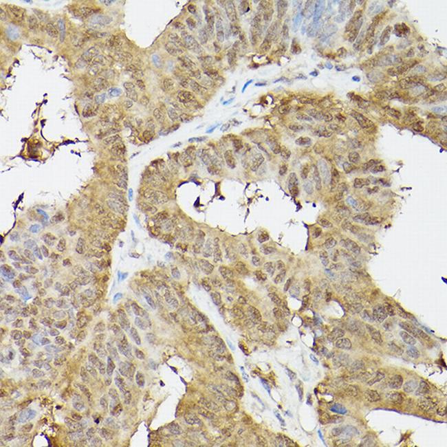 PSMA3 Antibody in Immunohistochemistry (Paraffin) (IHC (P))