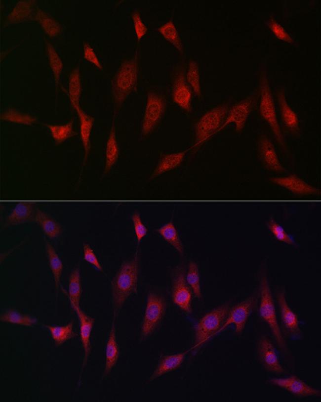 MSRA Antibody in Immunocytochemistry (ICC/IF)