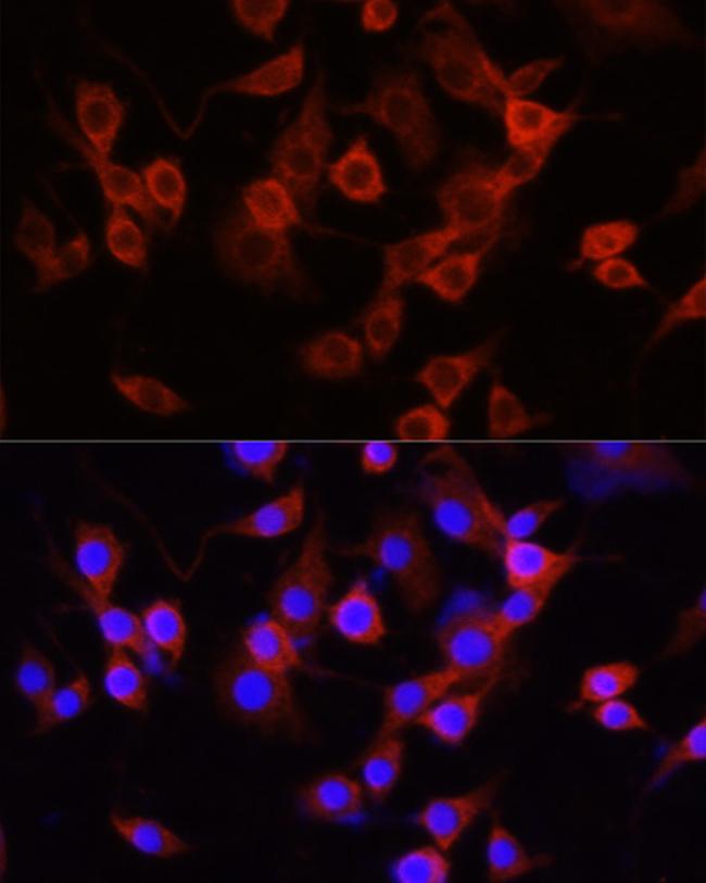 alpha-1 Antitrypsin Antibody in Immunocytochemistry (ICC/IF)