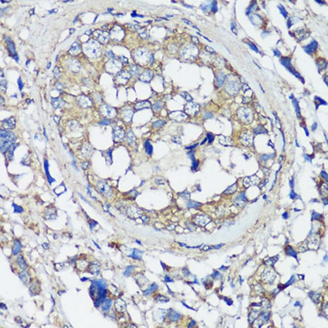 VAMP2 Antibody in Immunohistochemistry (Paraffin) (IHC (P))