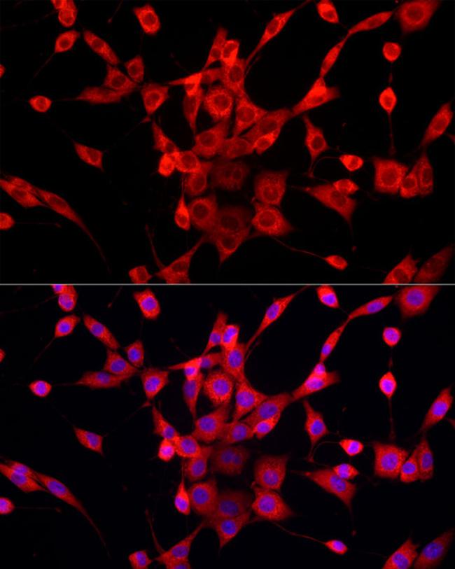 PEX5 Antibody in Immunocytochemistry (ICC/IF)