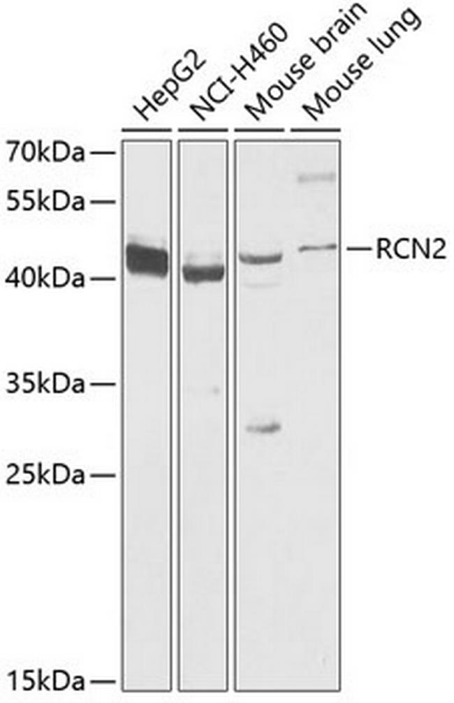 RCN2 Antibody in Western Blot (WB)