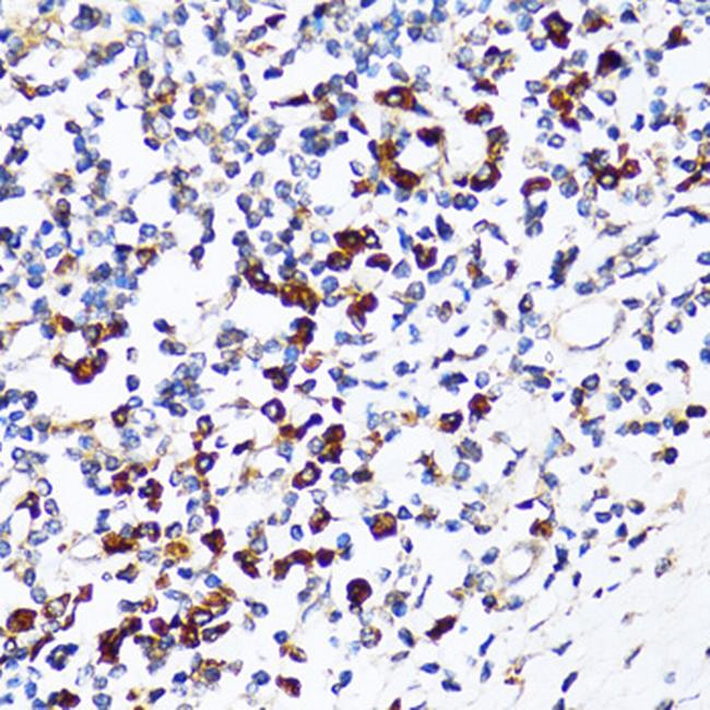 Ribophorin I Antibody in Immunohistochemistry (Paraffin) (IHC (P))