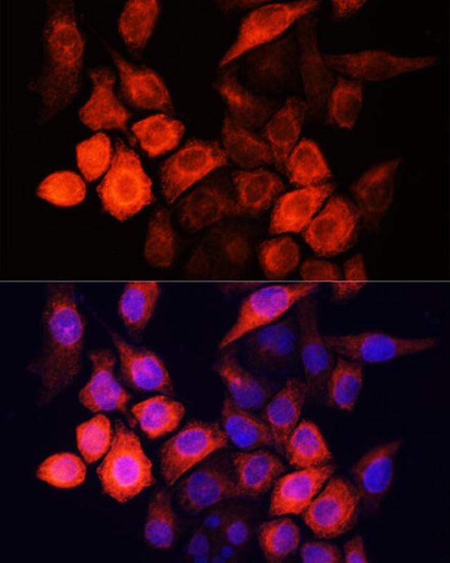 SHH Antibody in Immunocytochemistry (ICC/IF)