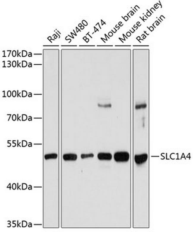 SLC1A4 Antibody in Western Blot (WB)