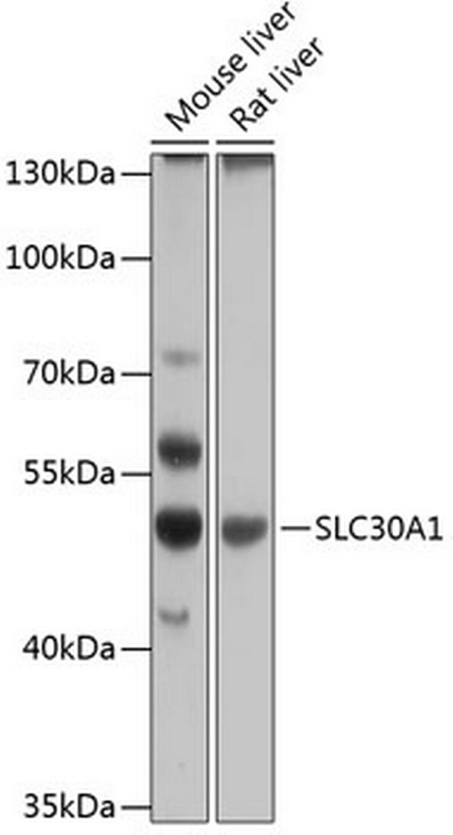 SLC30A1 Antibody in Western Blot (WB)