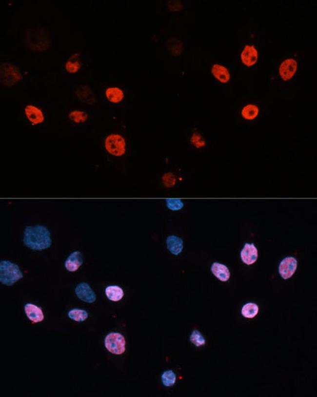 HDAC3 Antibody in Immunocytochemistry (ICC/IF)