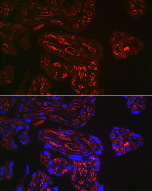 CD32b Antibody in Immunohistochemistry (Paraffin) (IHC (P))