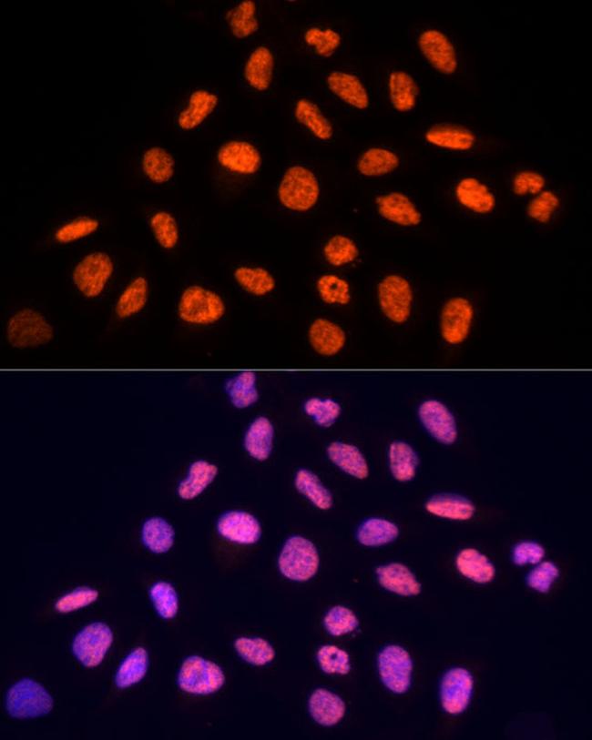 PRP19 Antibody in Immunocytochemistry (ICC/IF)