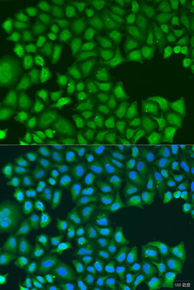 TIRAP Antibody in Immunocytochemistry (ICC/IF)