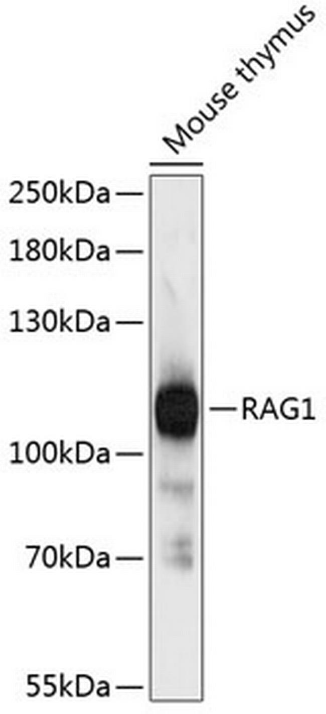 RAG1 Antibody in Western Blot (WB)